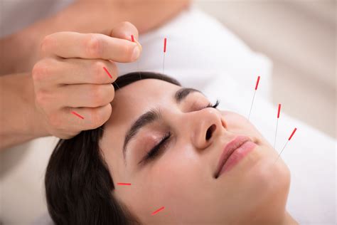 Practitioners place needles in spots other than the area of discomfort. . Good acupuncture near me